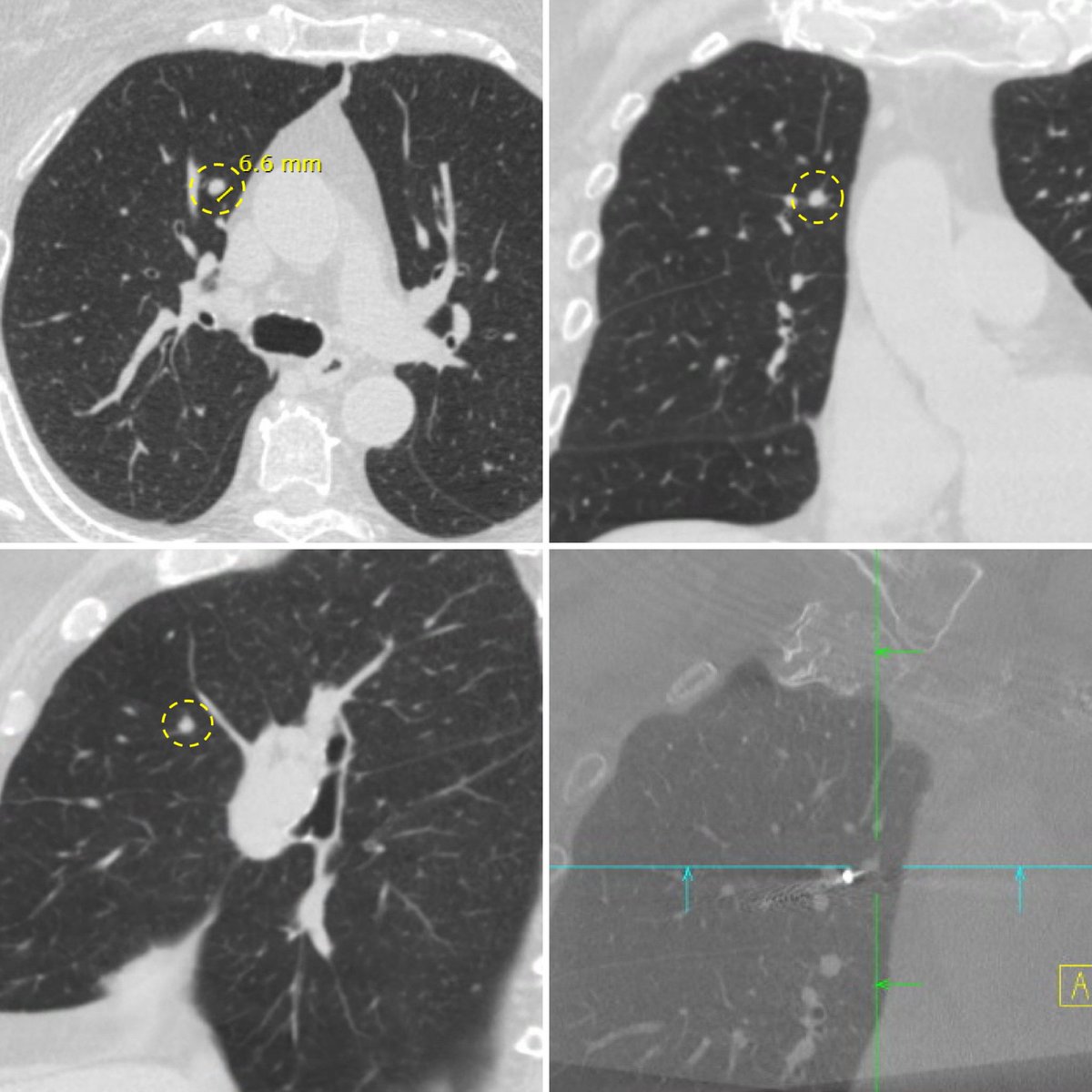 Ali Abedi MD FCCP DAABIP tweet media