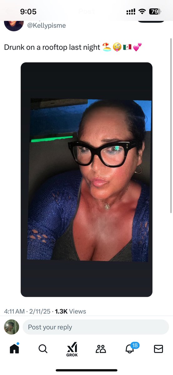 TS13Edit's tweet photo. @Kellypisme it should be the last one to talk about looks because wtf. 

lets talk about that sun damage because, wow, the sun clearly took this as a personal challenge. ur face is radiating enough UV aftermath to be classified as a cautionary tale in a dermatology textbook. https://t.co/Q1sh5DMo0p