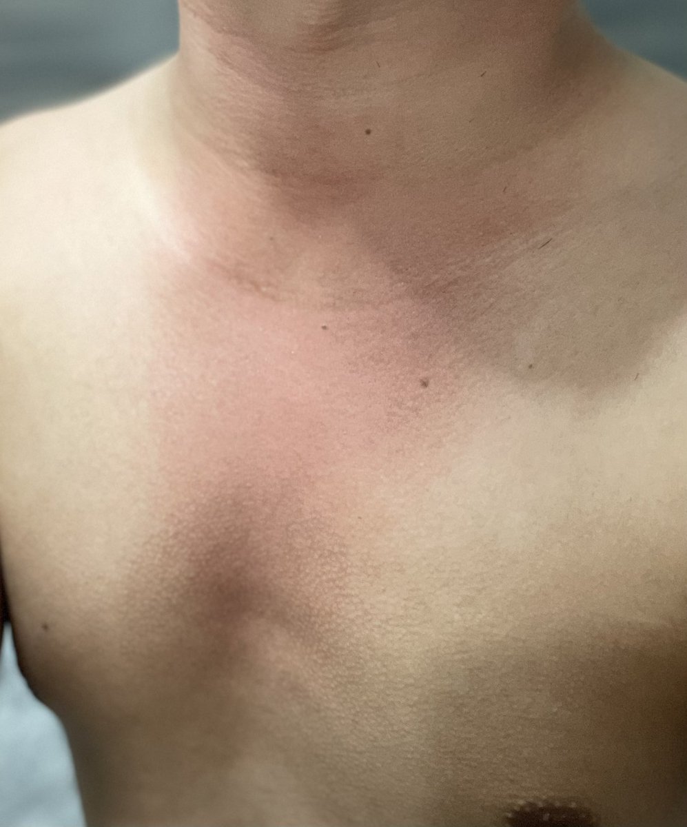 emmanzereso's tweet photo. Dagat pa-every 2weeks Noy👨🏾😢😅
#Hapdi #Saet 🥴 #OkayNaTo https://t.co/R3WsvbOpfp
