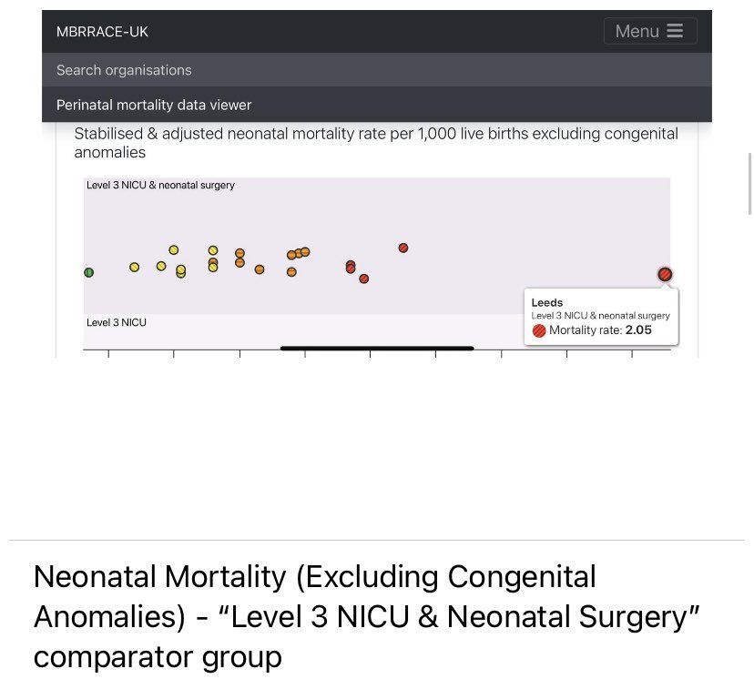 Further evidence of what we and other families failed by Leeds maternity services have been saying for a very long time…. The first graph is hugely alarming ‼️ 👀 🚨
