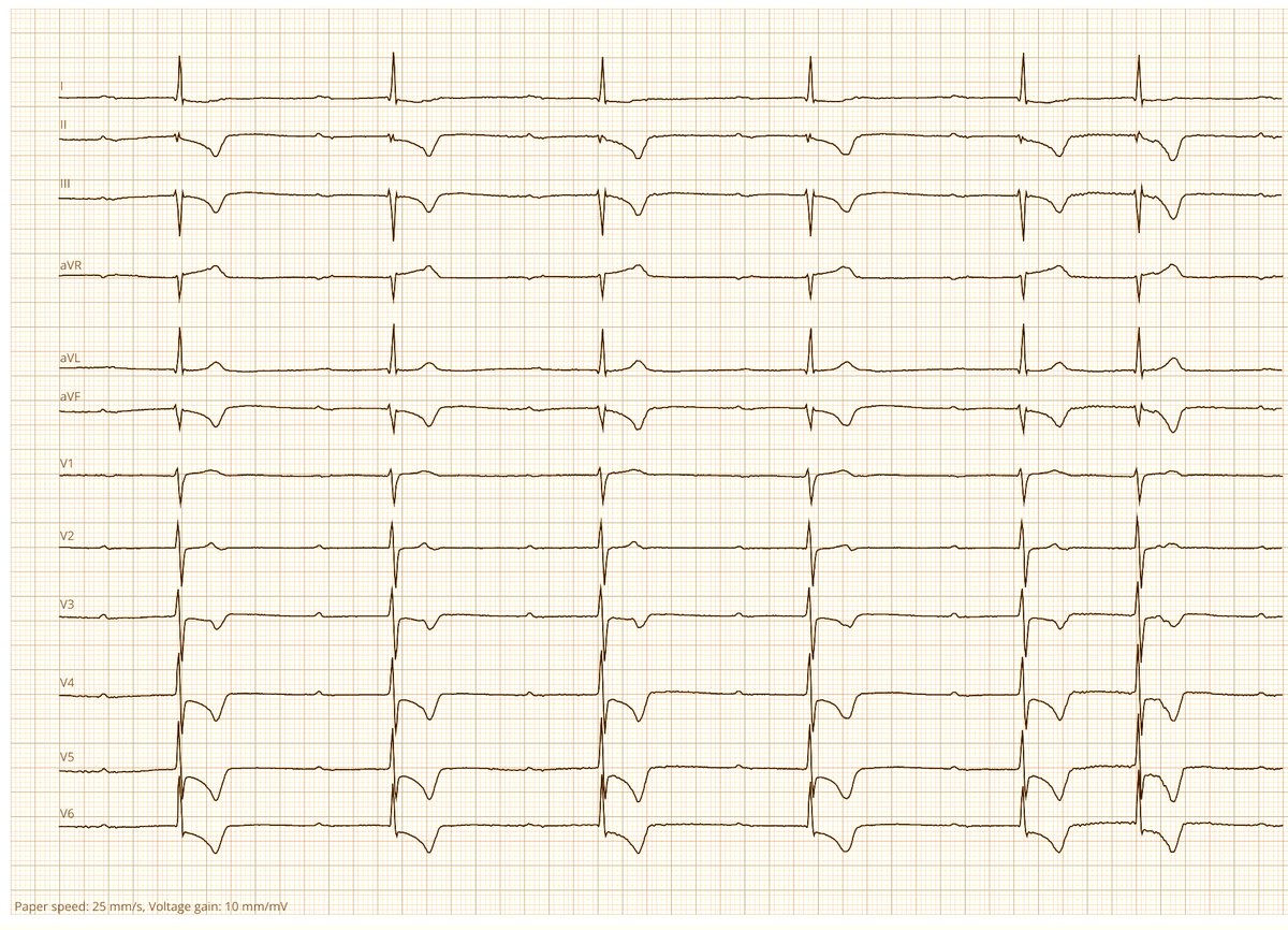 Dr. Andreas Roeschl tweet media