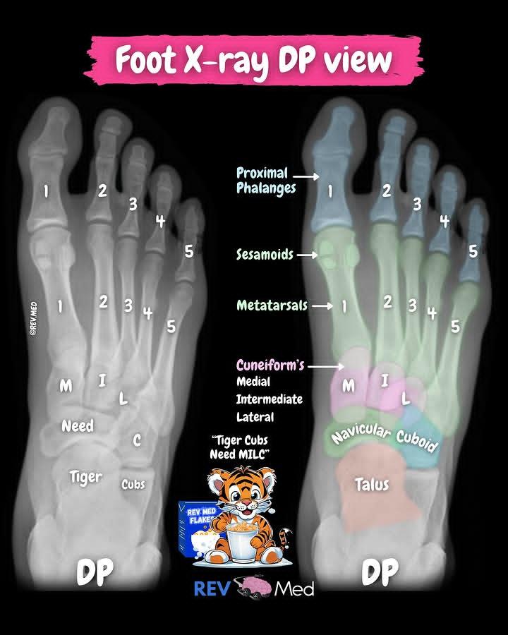 youngmudez29474's tweet image. We love this mnemonic for the foot bones anatomy. What’s cool is we also provide X-ray imaging for you to begin reviewing. Have a look! 

#medthreads