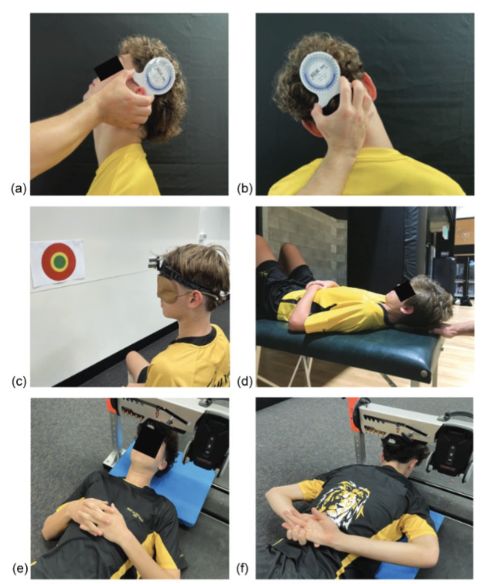 Felix Leung (@felixphysio) on Twitter photo 🚨New Publication 🚨
⬇️ neck LF strength ⬆️ extension ROM associated with ⬆️ head impacts during soccer heading ⚽️🥅💥
Full article👇
tandfonline.com/doi/epdf/10.10…
<a href="/JSportsSci/">Journal of Sports Sciences</a> 🚨New Publication 🚨
⬇️ neck LF strength ⬆️ extension ROM associated with ⬆️ head impacts during soccer heading ⚽️🥅💥
Full article👇
tandfonline.com/doi/epdf/10.10…
<a href="/JSportsSci/">Journal of Sports Sciences</a>
