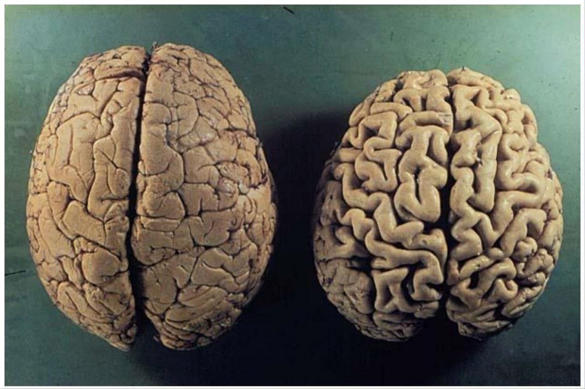 Everyone wants to take care of their body…

But no one takes care of their brain.

Most people just ignore it until something goes wrong.

So, here’s everything you need to know to heal &amp; protect your brain: