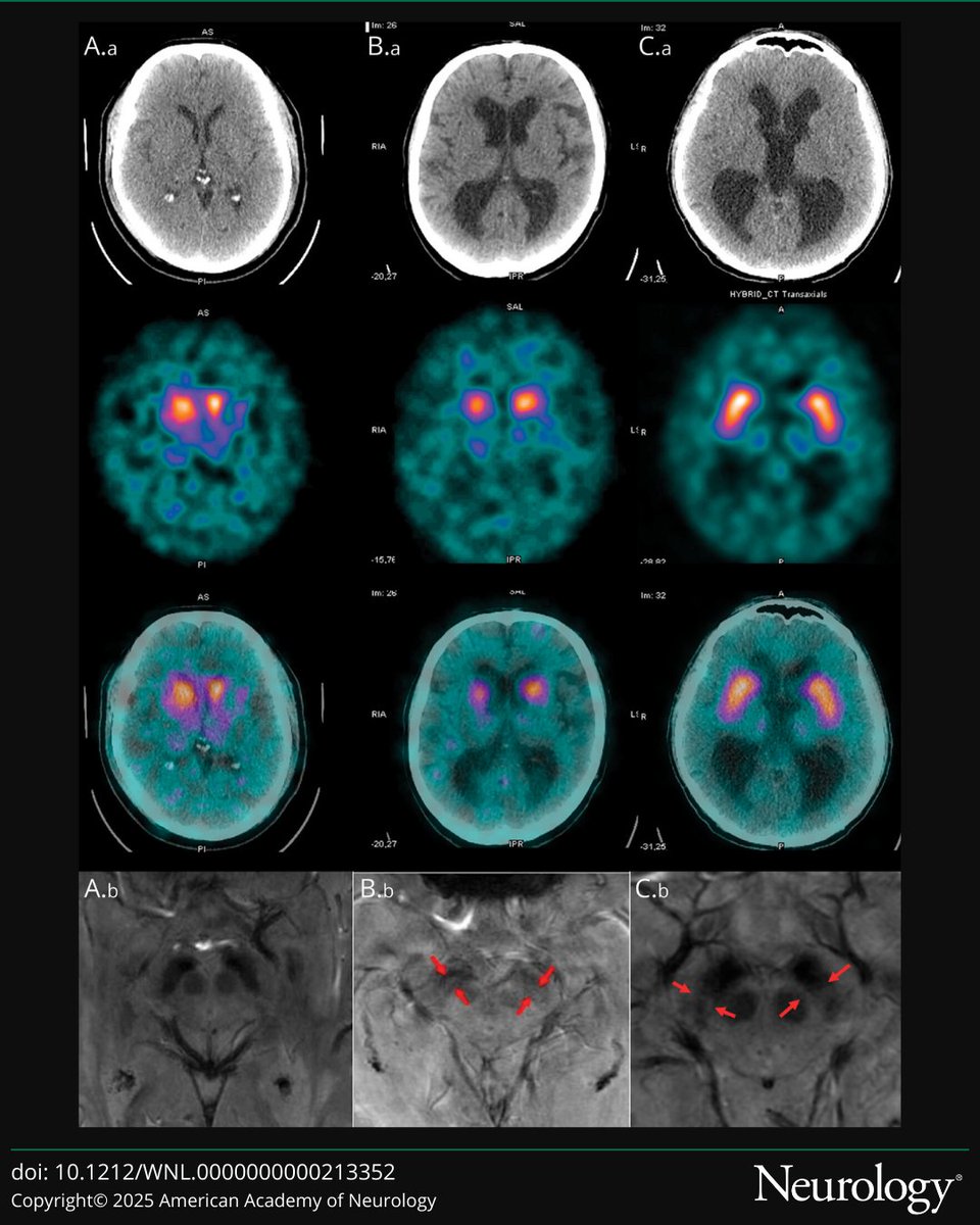 Neurology Journal tweet media