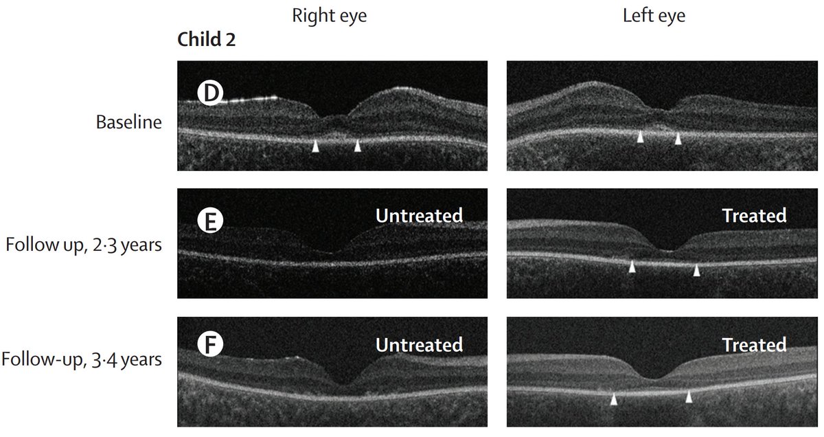 Samuel Hume tweet media