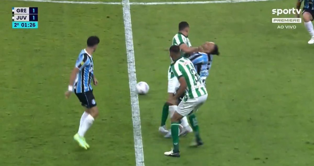 _clemir's tweet image. Fora o pênalti…

Uma cotovelada e um tapa na cara, e o VAR? Nada!

Nem precisa de VAR para isso também!

Juiz fraco e VAR ainda mais ridículo!

@OficialFGF