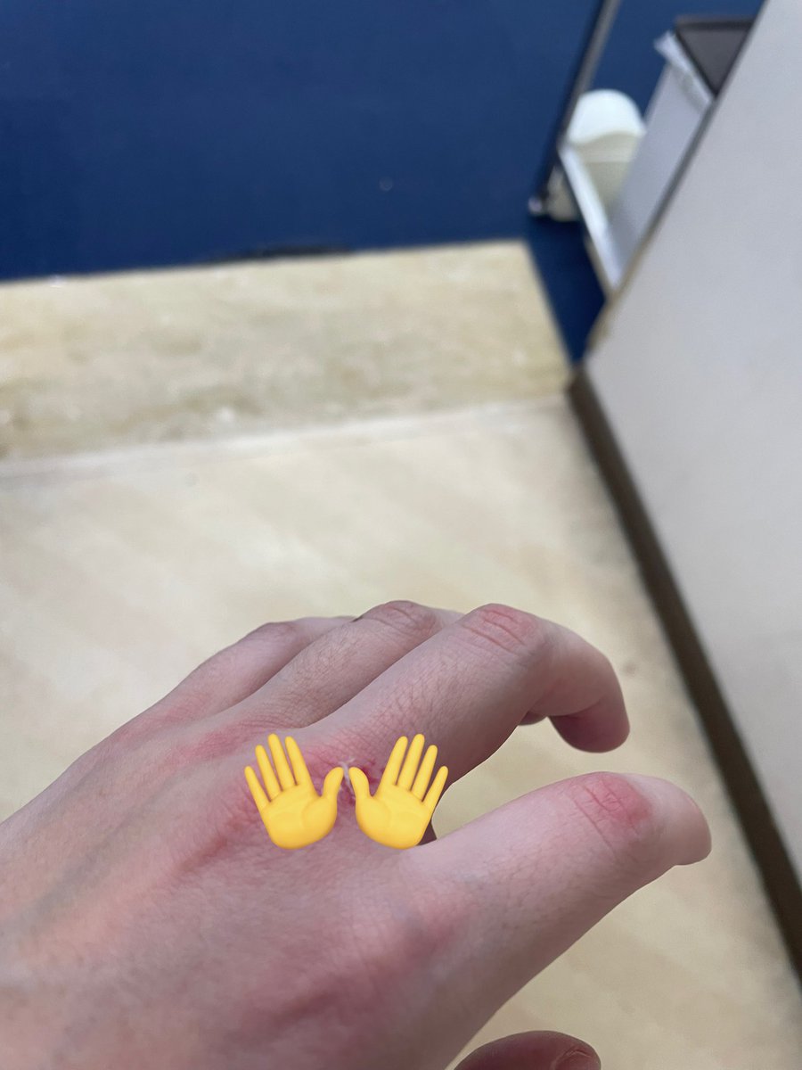 軍手のままサンドバッグで左フックの練習してたら血出てた🩸
新しく会ったトレーナーの人に初心者特有の癖とかない綺麗なフォームて言われて嬉しみ

 #引きこもりITエンジニアがプロボクサーになるまで
(9/1000)