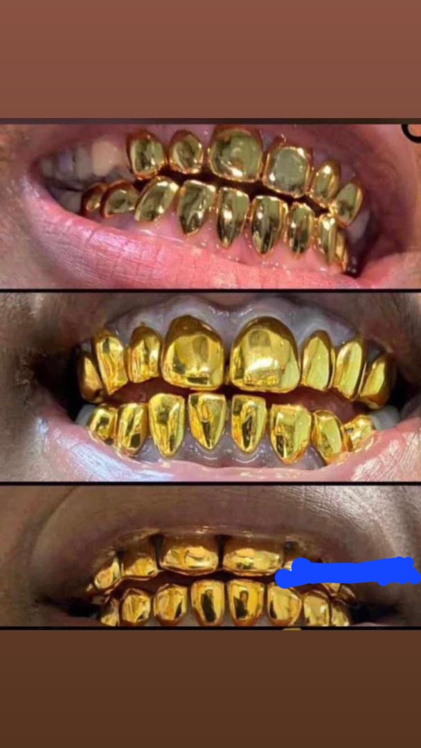 MuazuMusaGold's tweet photo. Come and fix your Gold teeth 😬
Whatssap Or 📞 09025742942 💬 https://t.co/zbx1OkOdue