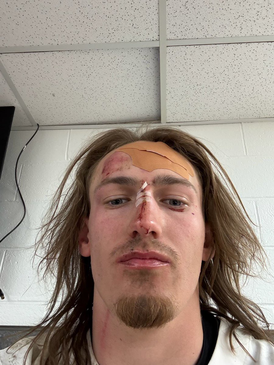 Hornet Baseball Alum put his body on the line for his pitchers! Dude had a heckuva weekend! 5 x 9, 4 BB, 6 SB