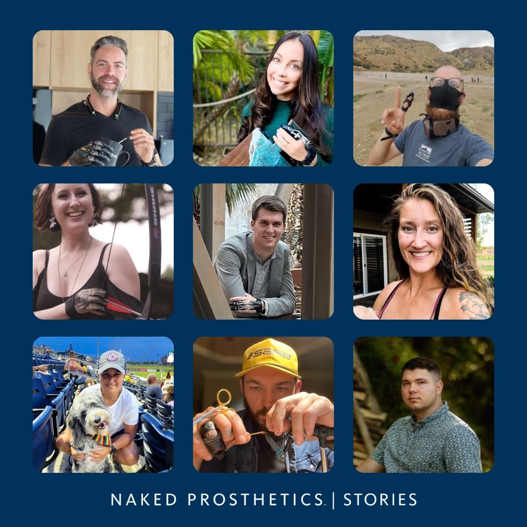 NPDevices's tweet image. #NPStories features different end-user journeys; from an auto-mechanic who has found his confidence again to a woman who has discovered an adventurous side of herself after trauma. Get to know some of our wearers: npdevices.com/stories

#NakedProsthetics #ItsAllAboutFunction