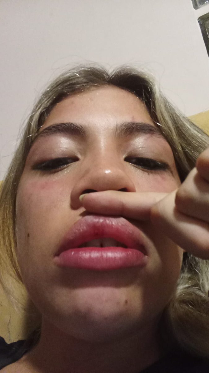 vickynavarro9_'s tweet image. A que punto llega la locura de la gente. Anoche salí a festejar mi cumpleaños con todos mis amigos en el club universitario, en un momento, se fueron a comprar a las barras, yo quede sola con mi mejor amiga y pasa la enferma de ORIANA GAMARRA (actual de mi ex novio Lionel Umaña)