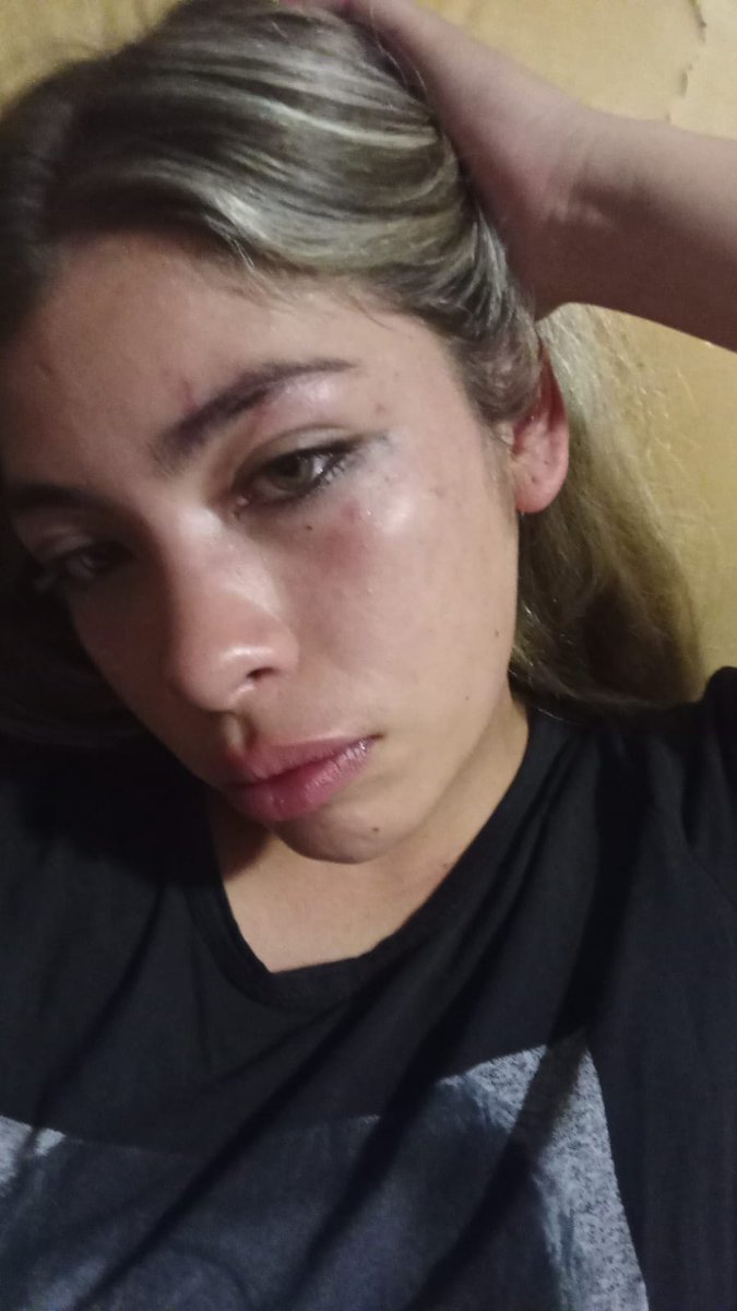 vickynavarro9_'s tweet image. A que punto llega la locura de la gente. Anoche salí a festejar mi cumpleaños con todos mis amigos en el club universitario, en un momento, se fueron a comprar a las barras, yo quede sola con mi mejor amiga y pasa la enferma de ORIANA GAMARRA (actual de mi ex novio Lionel Umaña)