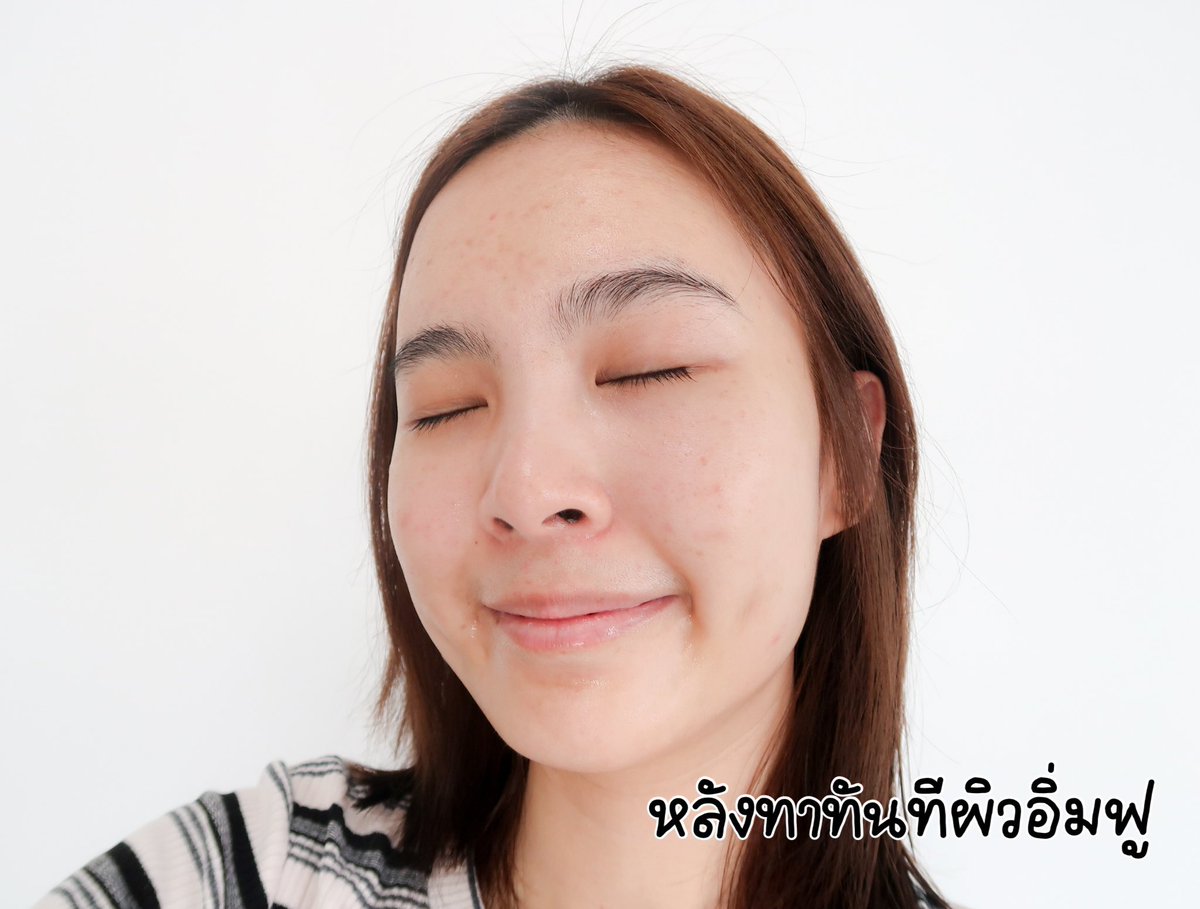 พออายุเกิน 25 เร่ิมมองหาสกินแคร์ที่ช่วงเรื่องริ้วรอยมาใช้ นี่ไปเจอไลน์สกินแคร์ของ Nectaphama ที่ปกติกินวิตามินของเค้าอยู่แล้วเลยหยิบสกินแคร์เค้ามาลองด้วยเลย Alchemi Wrinkle Expert M3 Peptide Serum #เปปโบเซรั่ม ที่ช่วยเรื่องริ้วรอยแบบเน้นๆ ทั้งริ้วรอยก่อนวัย ตามวัย คือจึ้งตรงที่มีเปปไทด์ที่การทำงานคล้ายโบแต่อันนี้ไม่ต้องเจ็บตัวจ้า ส่วนตัวใช้มารู้สึกว่าผิวกระชับขึ้น ริ้วรอยเล็กๆรู้สึกตื้นขึ้น แบบไม่มีความระคายเคือง ทาแล้วผิวดูอิ่มน้ำสุดๆ ใครอายุ 25+ แนะนำเลย