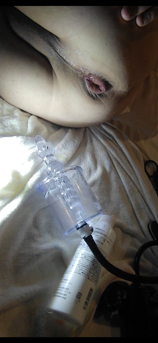 浣腸マニアのS様に会いたいなー😊昔イルリで大量浣腸されて吸引器で吸われたときはホントに気持ちかったから誰かもう一度体験させてください🩷