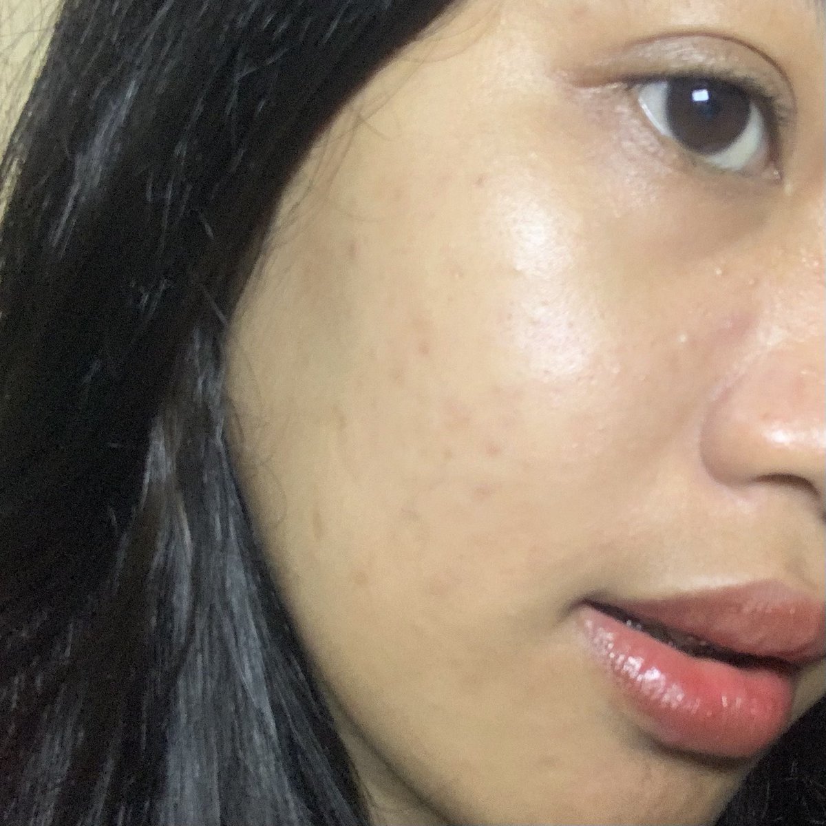 for calming my redness and hydrating my skin aku selalu ngandelin moist yg satu ini!