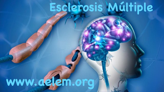 dasmi73's tweet photo. Comenzamos la semana, a por ella ¡¡valientes!! 💪🏻¿Sabes lo que es la #EsclerosisMúltiple? 🤔La mayoría de personas que nos siguen lo saben, pero, ¿tú? ¿Quieres saber a qué nos enfrentamos? Pues te lo pongo fácil, pincha el enlace 😉 ➡️ https://t.co/aLQdTO0KpS
#AELEM #EM https://t.co/ve9ww5UYJX
