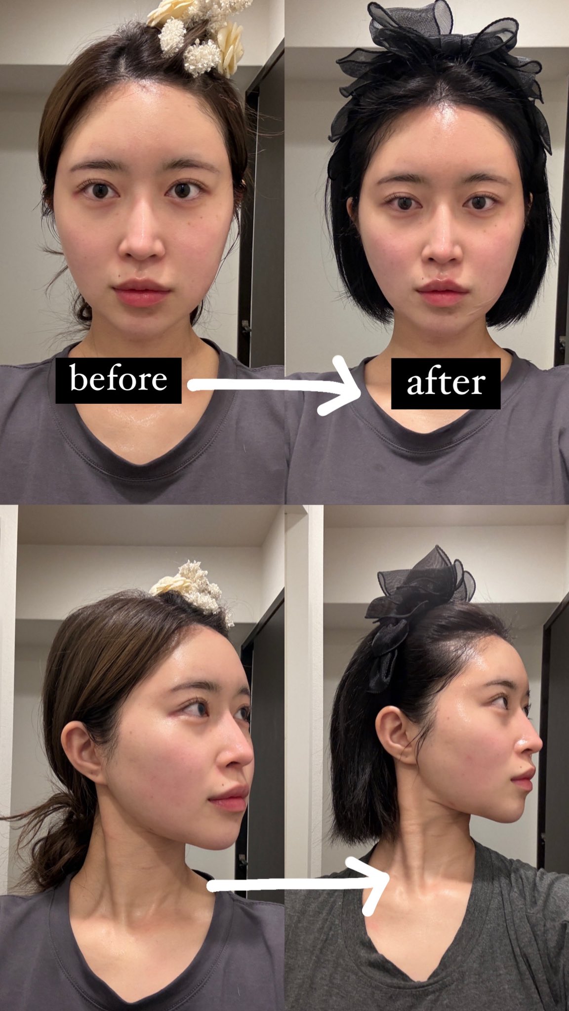 メディキューブ美顔器 ハイフォーカスショット AGE-R ブースタープロ｜MEDICUBEの口コミ - まさかまさかの家庭