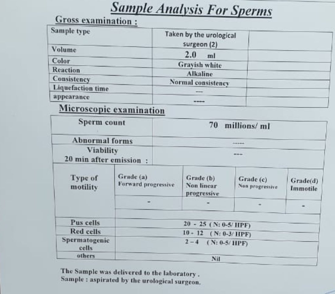 Mohamedendourol's tweet photo. Seminal Vesiculoscopy’s for “failed TUR Deroofing “ of large Midline prostatic cyst
Who want to watch the Video? ✌️join us @AUA2025!
#seminal #Vesiculoscopy’s is Real 👇
#Obstructive #Azoospermia @GoumasUrologia @KaLunChui @KariTikkinen @drkemalsarica @UrowebESU https://t.co/phu9l9pwqC