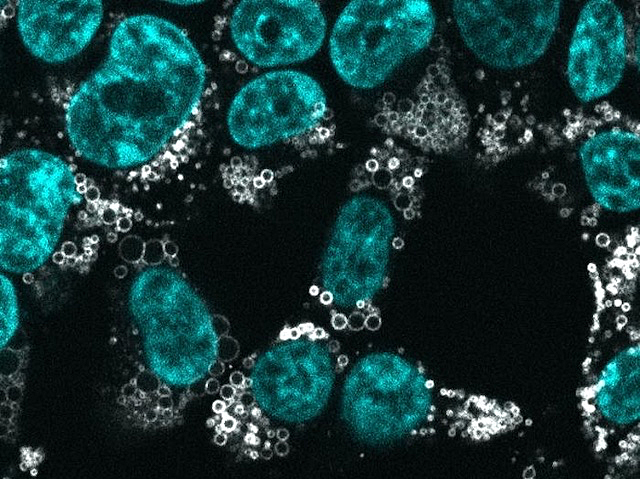 Biomedical Picture of the Day BPoD (@bpod_s) on Twitter photo A high-res approach to localise thousands of proteins within a cell
📷: Marco Hein, Duo Peng, Verina Todorova, Frank McCarthy, Kibeom Kim, Chad Liu et al <a href="/czbiohub/">Chan Zuckerberg Biohub Network</a> in <a href="/CellCellPress/">Cell</a>
➡️: bpod.org.uk/archive/2025/2… with <a href="/rooph/">Ruth Williams</a> A high-res approach to localise thousands of proteins within a cell
📷: Marco Hein, Duo Peng, Verina Todorova, Frank McCarthy, Kibeom Kim, Chad Liu et al <a href="/czbiohub/">Chan Zuckerberg Biohub Network</a> in <a href="/CellCellPress/">Cell</a>
➡️: bpod.org.uk/archive/2025/2… with <a href="/rooph/">Ruth Williams</a>