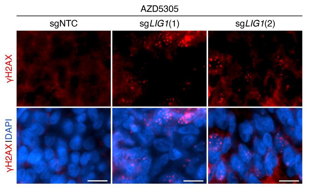 Journal of Clinical Investigation (@jclinicalinvest) on Twitter photo How can we make PARP inhibitors more effective in castration-resistant prostate cancer?
<a href="/FrancescaBZNY/">Francesca Demichelis</a> et al. identify the DNA repair gene LIG1 as a sensitizer to PARP inhibitors in multiple tumor models: jci.org/articles/view/…
<a href="/FraLo05/">Francesca Lorenzin</a> <a href="/GiuliaFracassi_/">Giulia Fracassi</a> <a href="/CIBIO_UniTrento/">CIBIO - UniTrento</a> How can we make PARP inhibitors more effective in castration-resistant prostate cancer?
<a href="/FrancescaBZNY/">Francesca Demichelis</a> et al. identify the DNA repair gene LIG1 as a sensitizer to PARP inhibitors in multiple tumor models: jci.org/articles/view/…
<a href="/FraLo05/">Francesca Lorenzin</a> <a href="/GiuliaFracassi_/">Giulia Fracassi</a> <a href="/CIBIO_UniTrento/">CIBIO - UniTrento</a>