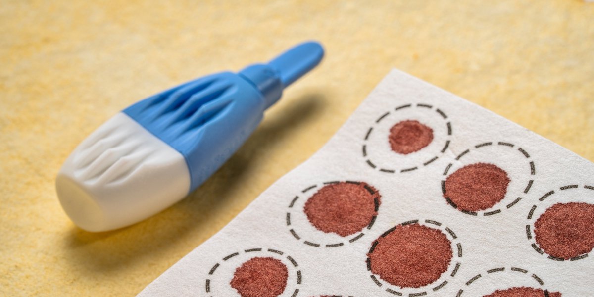 Neurology Journal (@greenjournal) on Twitter photo Learn about the diagnostic potential of dried blood spot sampling for neuromyelitis optica spectrum disorder (NMOSD) in resource-limited settings in this Neurology blog: hubs.la/Q037sd3L0
#GlobalNeurology #NeuroTwitter <a href="/MSahuMD/">Malya Sahu, MD</a> Learn about the diagnostic potential of dried blood spot sampling for neuromyelitis optica spectrum disorder (NMOSD) in resource-limited settings in this Neurology blog: hubs.la/Q037sd3L0
#GlobalNeurology #NeuroTwitter <a href="/MSahuMD/">Malya Sahu, MD</a>