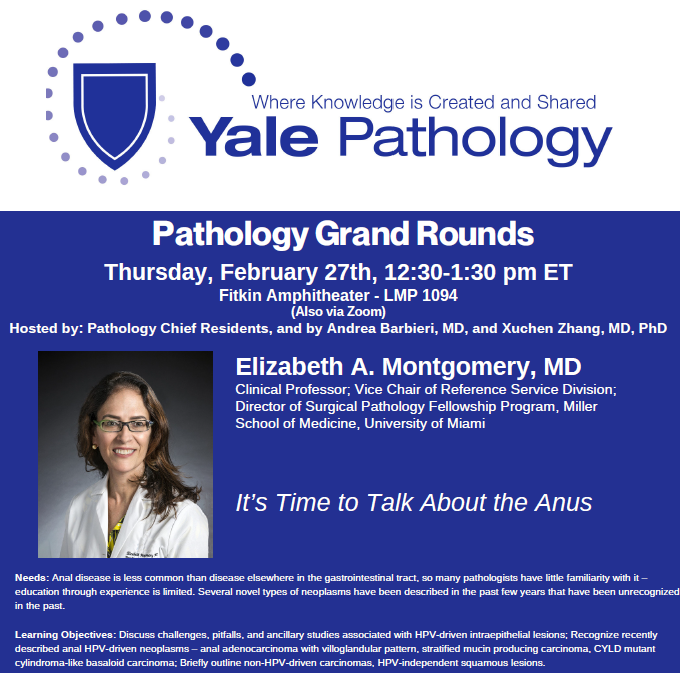 Yale Pathology (@yalepathology) on Twitter photo Join us for #Pathology Grand Rounds on Thur., Feb. 27 at 12:30 PM ET as <a href="/LizMontgomeryMD/">Elizabeth Montgomery, MD</a> of <a href="/umiamimedicine/">Miller Medicine</a> presents on cancers of the anus, It’s Time to Talk About the Anus. Dr. Montgomery is also founder of <a href="/science_press/">Innovative Science Press</a>. <a href="/YaleMed/">Yale School of Medicine</a> <a href="/YaleCancer/">Yale Cancer Center</a> bit.ly/4kgeo4K Join us for #Pathology Grand Rounds on Thur., Feb. 27 at 12:30 PM ET as <a href="/LizMontgomeryMD/">Elizabeth Montgomery, MD</a> of <a href="/umiamimedicine/">Miller Medicine</a> presents on cancers of the anus, It’s Time to Talk About the Anus. Dr. Montgomery is also founder of <a href="/science_press/">Innovative Science Press</a>. <a href="/YaleMed/">Yale School of Medicine</a> <a href="/YaleCancer/">Yale Cancer Center</a> bit.ly/4kgeo4K