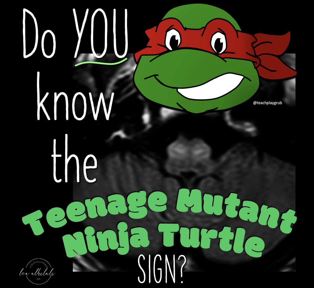 1/”That’s a ninja turtle looking at me!” I exclaimed. My fellow rolled his eyes at me, “Why do I feel I’m going to see this a thread on this soon…” 

He was right! A thread about one of my favorite imaging findings &amp; pathology behind it