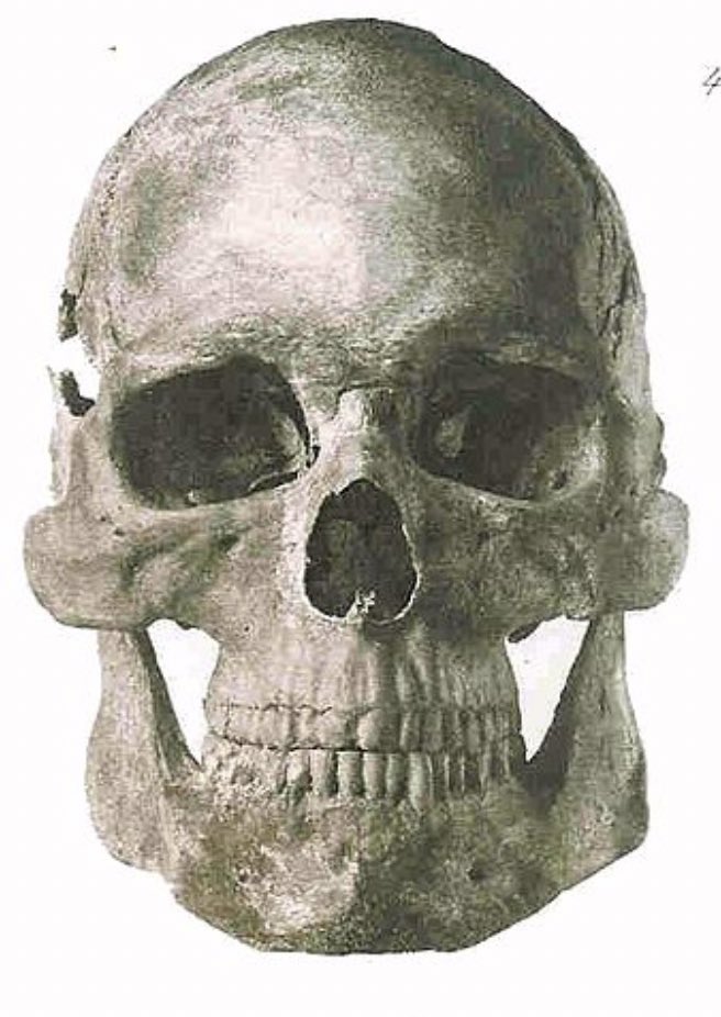 Fermented milk products like raw Cheeses or raw Kefir are excellent foods to stimulate bone growth. There is a reason the Yamnaya had such big skulls. They were consuming lots of raw dairy and especially Kumis (fermented horse milk).

The vitamin K2 content increases