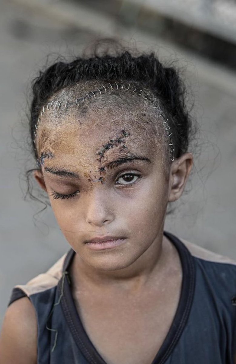 lsraeI did this. Never Forget