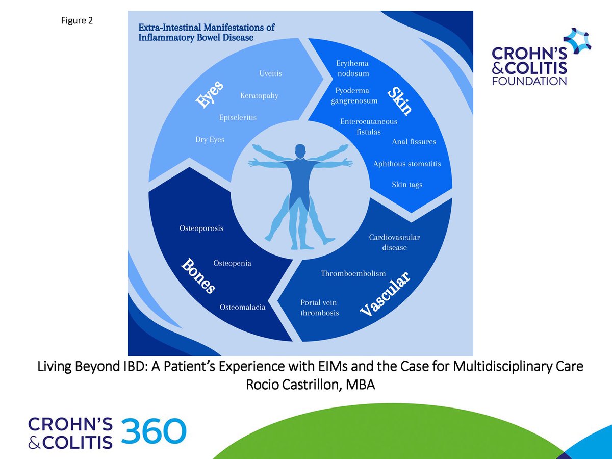 VoiceForIBD's tweet image. I’m thrilled to share my patient #editorial on #extraintestinal manifestations is published in #CC360✍🏼In this editorial, I dive into my personal experiences w/#IBD #EIMs &amp;amp; emphasize the importance of #multidisciplinary #patient care👩🏻‍⚕️👨🏼‍⚕️

Read editorial🔗 bit.ly/LivingBeyondIB…
