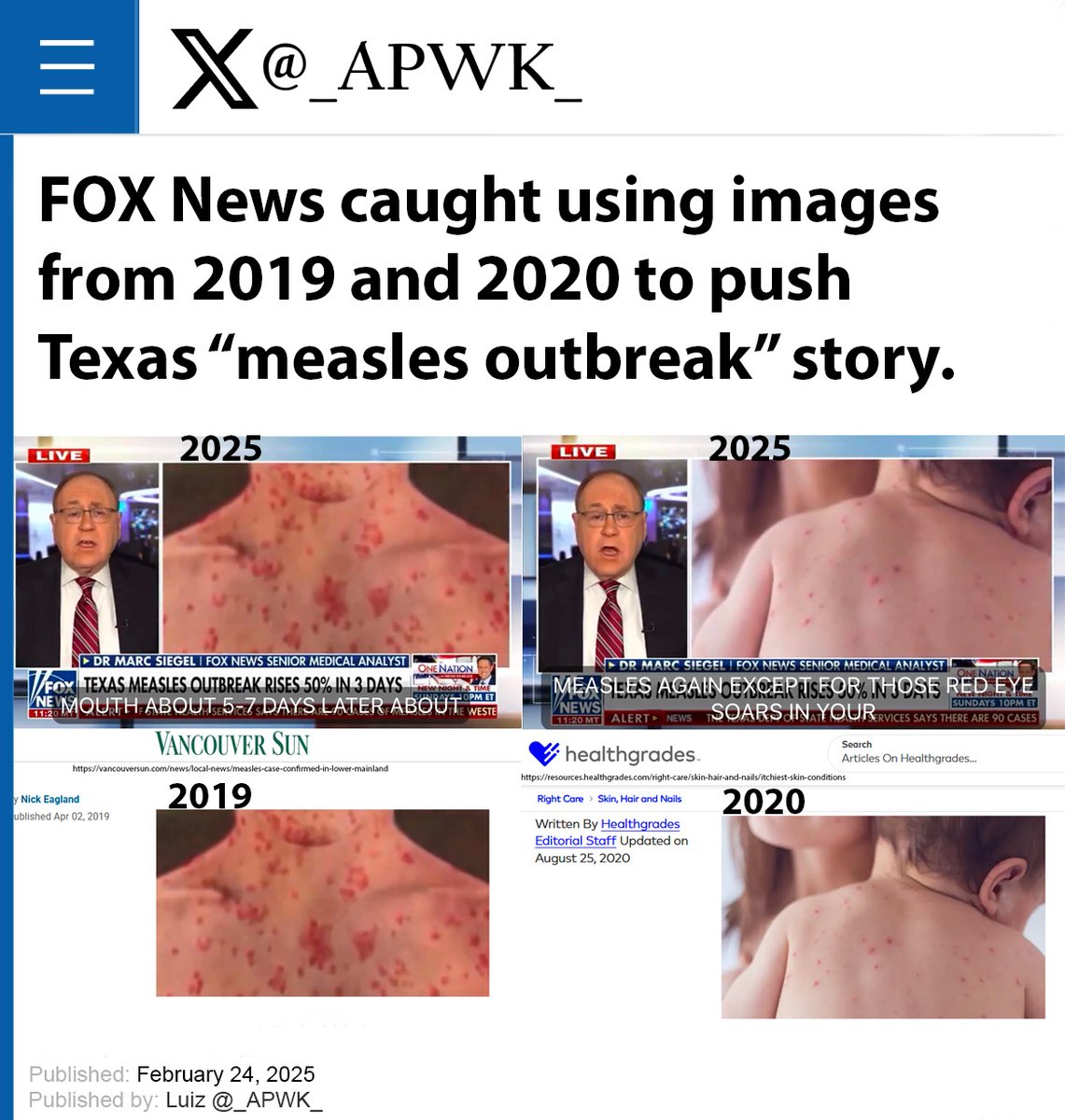 Luizmd's tweet photo. Fox News gets caught using images from 2019 and 2020 to push the Texas "measles outbreak" propaganda. https://t.co/MwiFxXzDYP