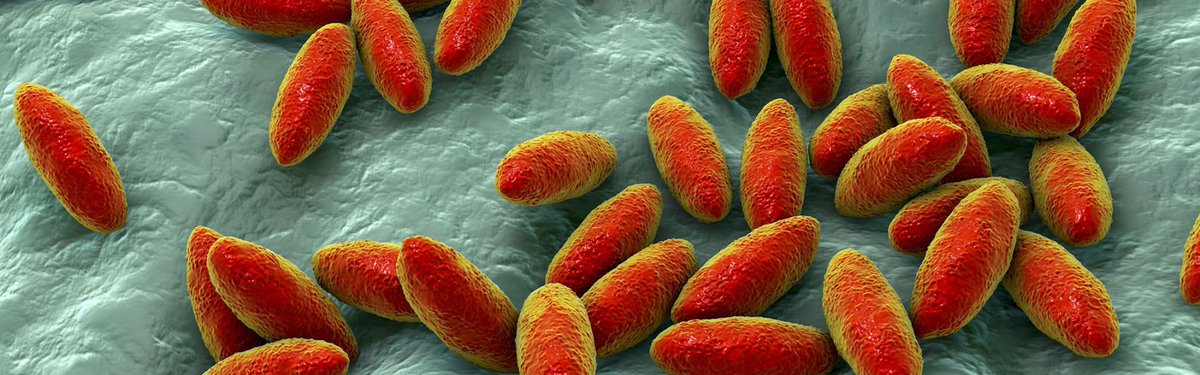 I recently treated a patient with Brucellosis 

It's an infection caused by the bacteria called Brucella 

It got into his spine, causing severe pain and disability 

He needed many weeks of antibiotics 

How did he get it?

By drinking raw milk 

Not a good idea