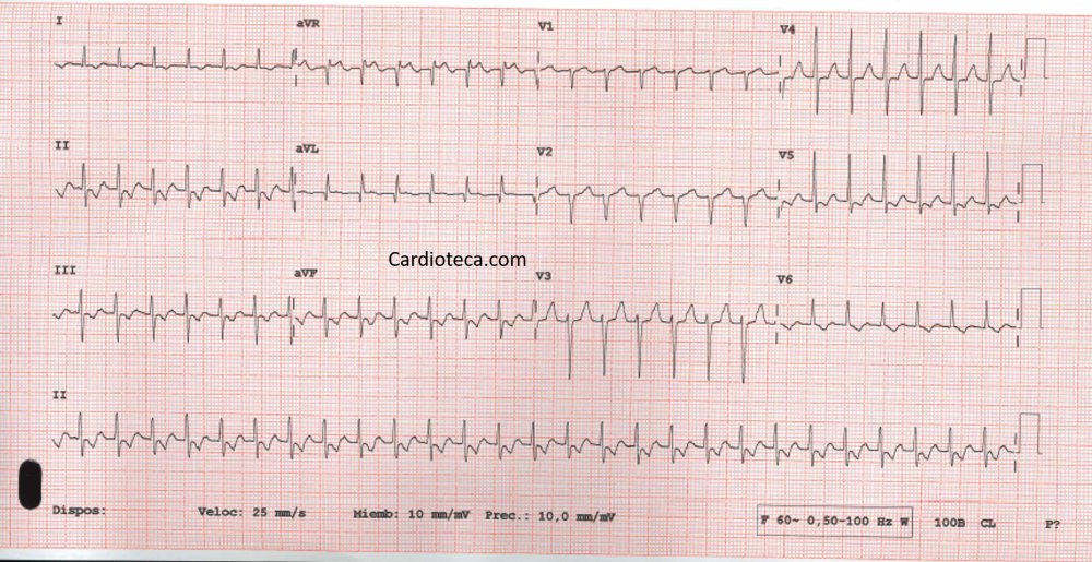 CardioTeca tweet media