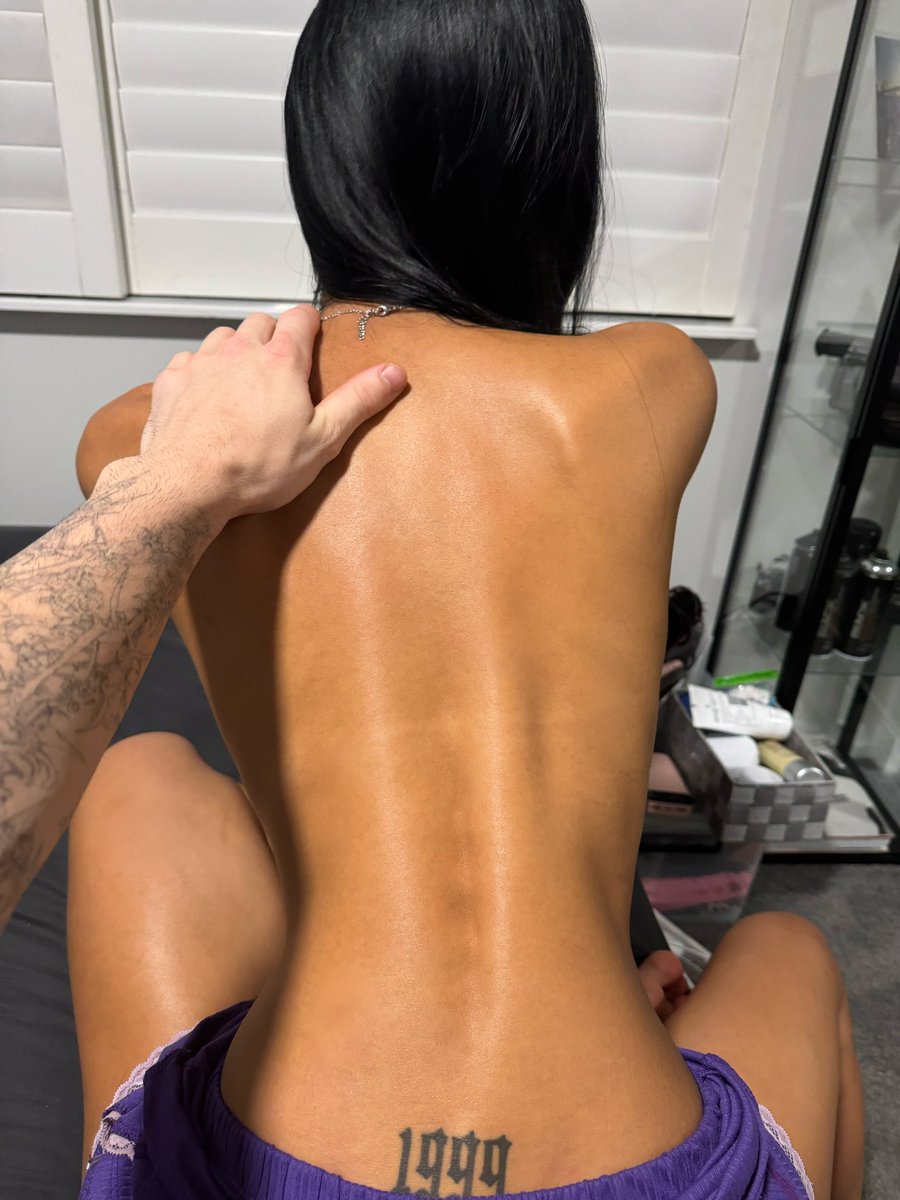 namarisback's tweet photo. Just checked the scoliosis xxx https://t.co/7zgmRCAoad