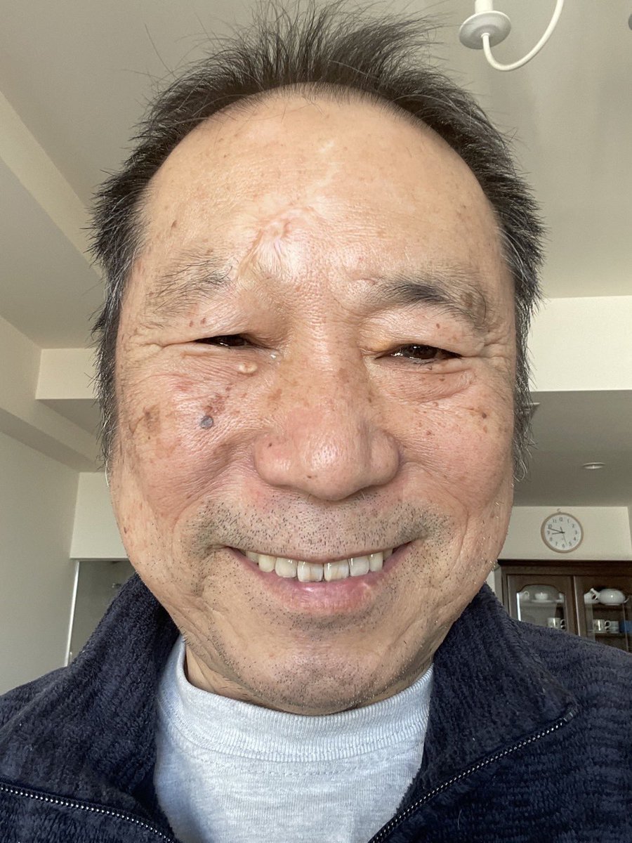ChikadaHaruo's tweet photo. 74歳になりました。こんな感じです。 https://t.co/ZQar3kr2FL