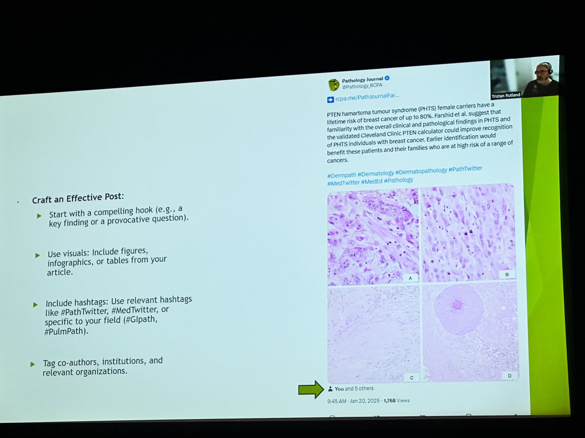 #gynpath
#placentalpath
#breastpath 🤎🤎

Pathology Update 2025. Thank you <a href="/PathologyRCPA/">The Royal College of Pathologists of Australasia</a> #pathTwitter