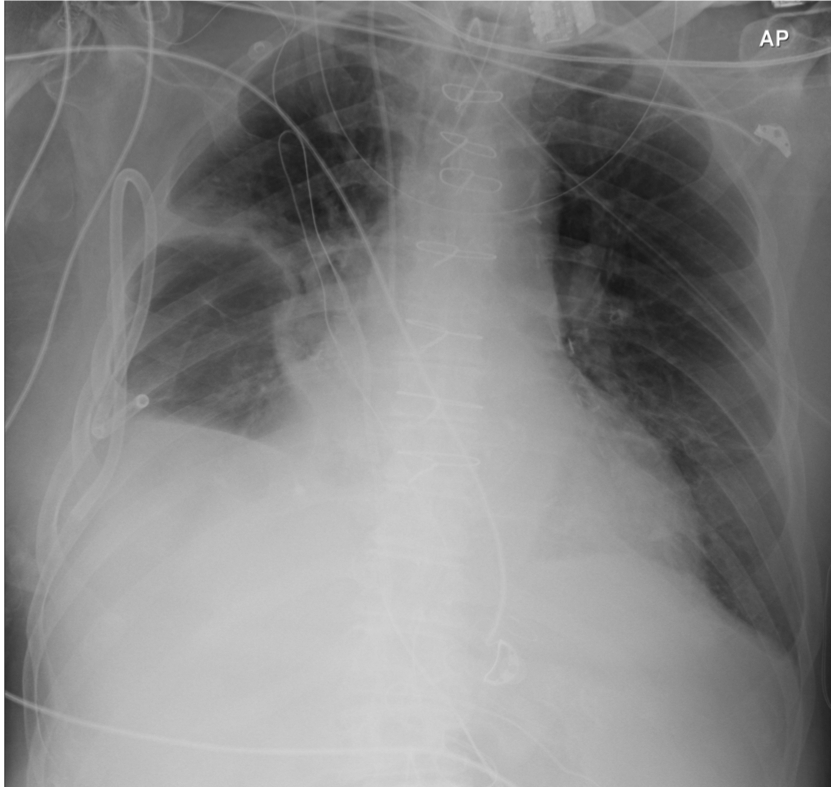 Mike Donnino, MD tweet media