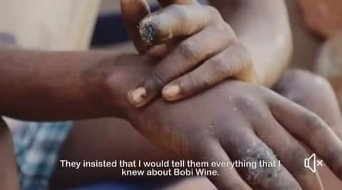 NupQuin's tweet image. His fingers were cut off by his abductors for being a member of the @NUP_Ug..!!
#StopAbductionsUG