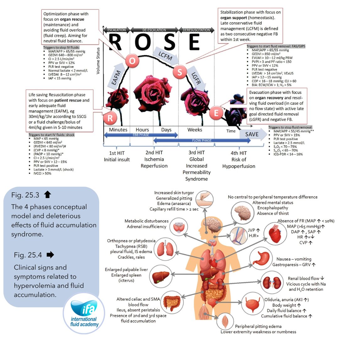 Monitoring Hypervolemia and Guiding Deresuscitation

🔹 Clinical Signs

• Elevated blood pressure (mean, systolic, diastolic, pulse pressure)
• Decreased heart rate, increased jugular venous pressure
• Peripheral edema, anasarca, altered mental status
• Positive fluid