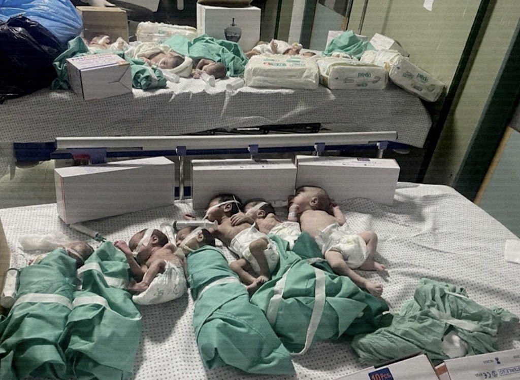 ارتفع العدد إلى خمسة اطفال تجمدوا وتوقفت قلوبهم على الهواء مباشرة من شدة البرد 

هذه كارثة حقيقية تحتاج تدخل عاجل، اغيثوا غزة يا ناس !!