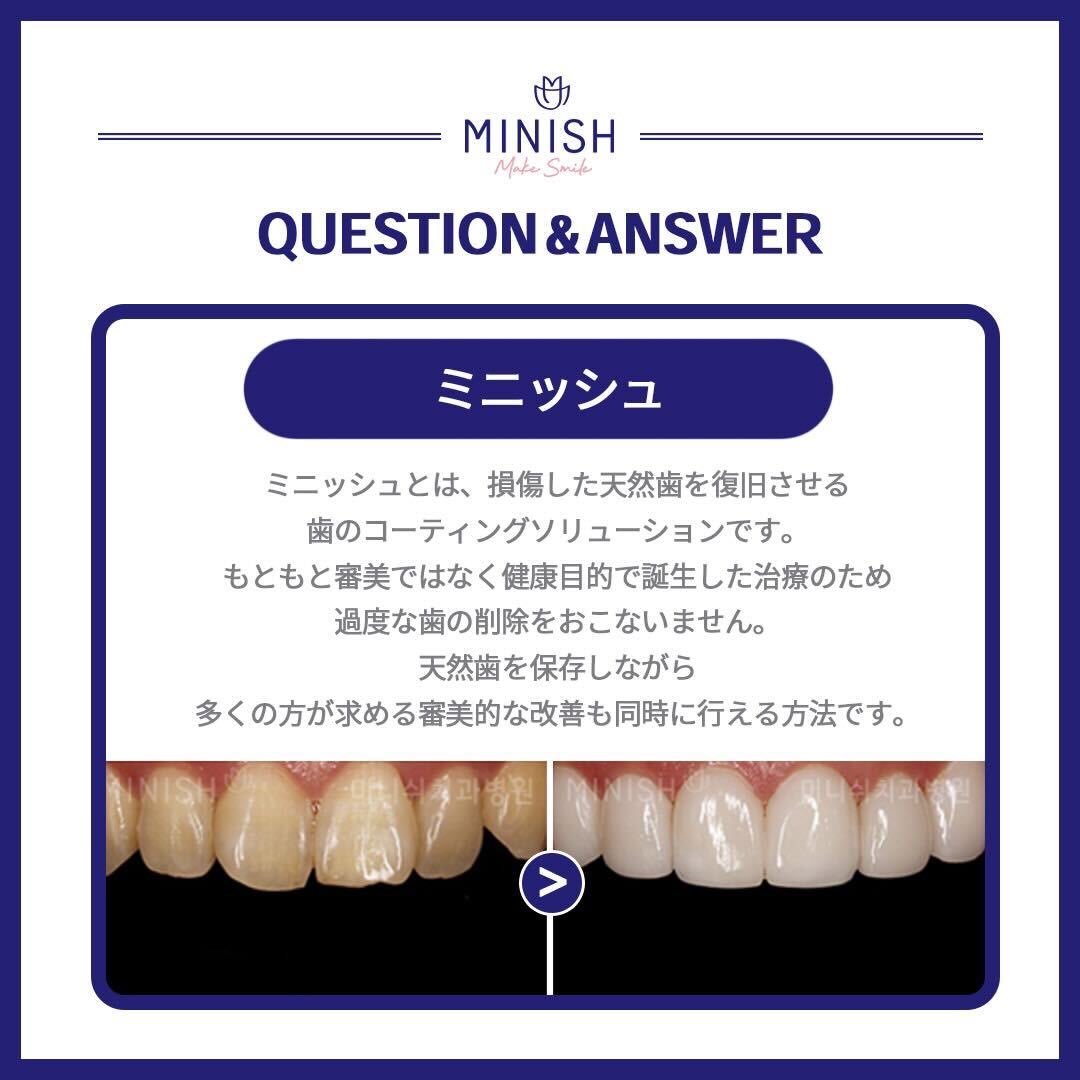 b55fq's tweet photo. やっぱミニッシュの歯可愛すぎる🥺
ハニとかダニエルもやってるらしいけどザセラミック！って感じじゃなくて綺麗。
両顎して歯見えなくなった韓国の子もミニッシュやって可愛くなってた🦷 https://t.co/KSPN4k2EoB
