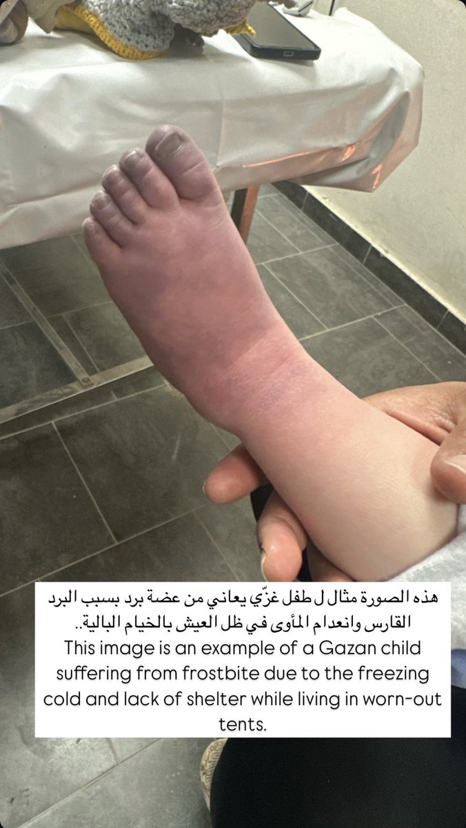 يموت الأطفال في غزة من البرد اضافة الى الجوع والقتل والتشريد