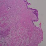 Photo by Dr Aygün Yörükoğlu (@pathologistAy)