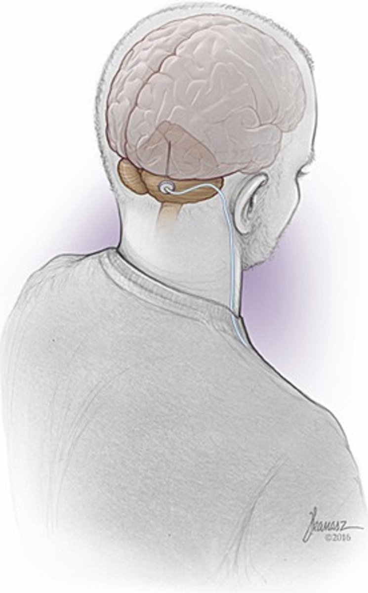 The proceedings for the DBS Think Tank 12 are now out! Put together by super fellow Enrique Martinez. Read about NeuroAI, cerebellar DBS, nanoparticles and more!

frontiersin.org/journals/human…