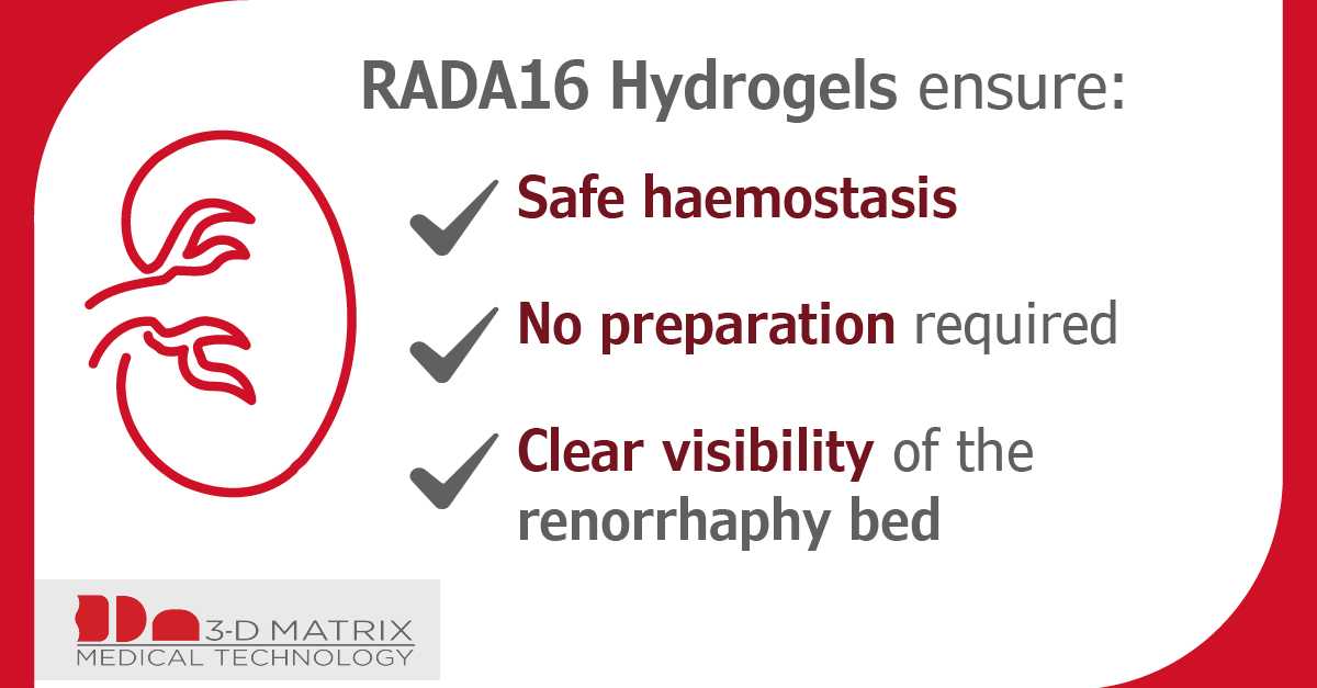 3dm_emea's tweet photo. With no preparation required and clear visibility, #RADA16 peptide hydrogels can streamline your #PartialNephrectomy procedure, helping create a smoother and more efficient workflow for your surgical team and the patient. Learn more at https://t.co/ZX88EroNdQ
#urology #3dmatrix https://t.co/Xll2VuTiDB