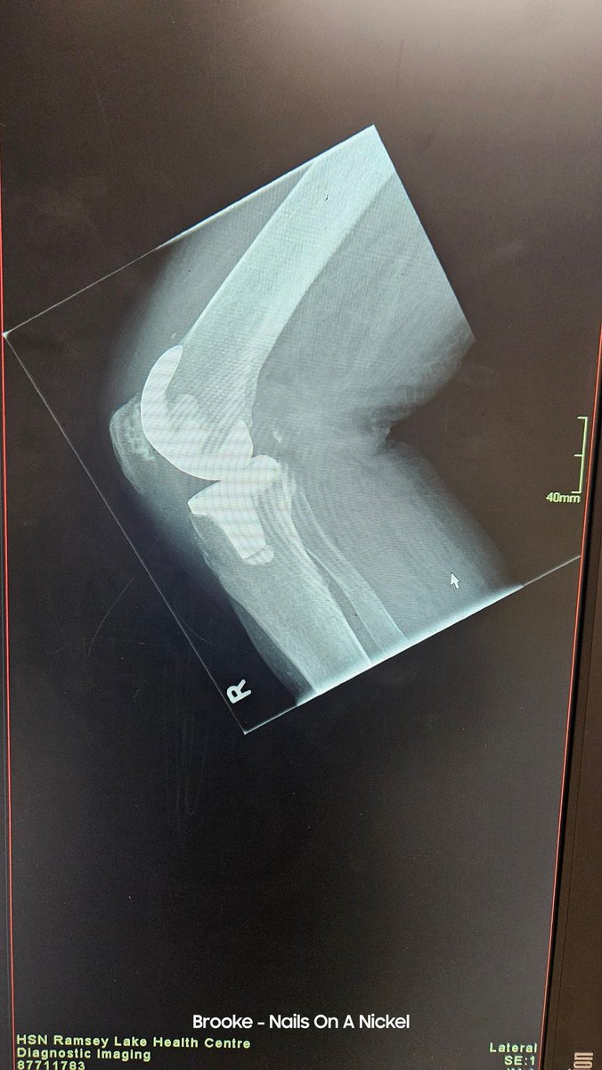 Things are looking great!