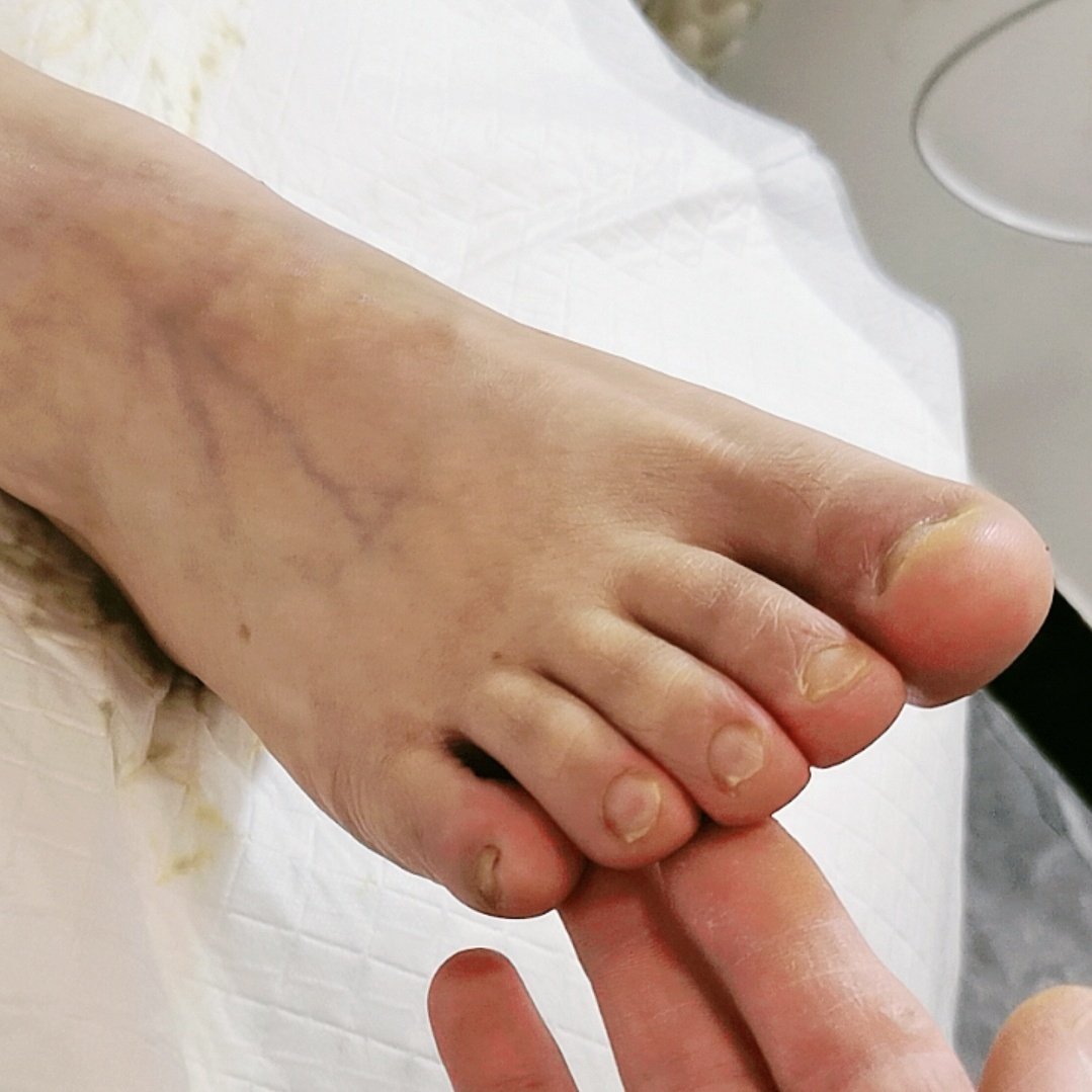 Man with small feet tweet media