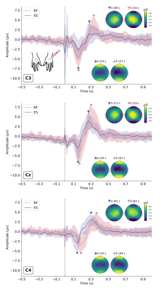 [Pain] Mista et al.: "Radiofrequency stimulation represents a viable alternative in the experimental and clinical assessment of the nociceptive system." doi.org/10.1016/j.clin…