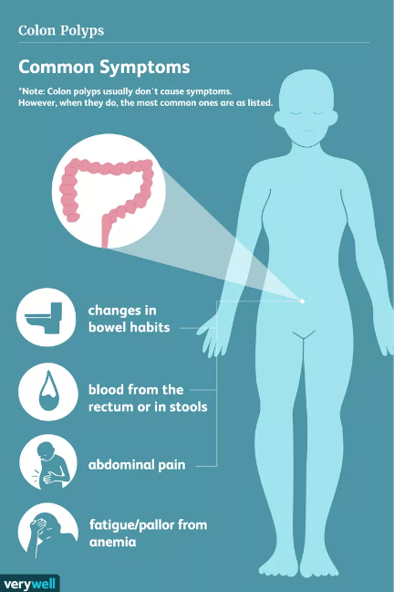 Gastro_11's tweet image. Understanding Colon Polyps: Types, Risks, and Prevention 🏥🔍 Learn more about their impact on your health.
verywellhealth.com/what-are-the-d…

#ColonPolyps #ColonCancer #Gastroenterology #ColorectalScreening #Colonoscopy #ScreeningColonoscopy #ReddingGastroCare